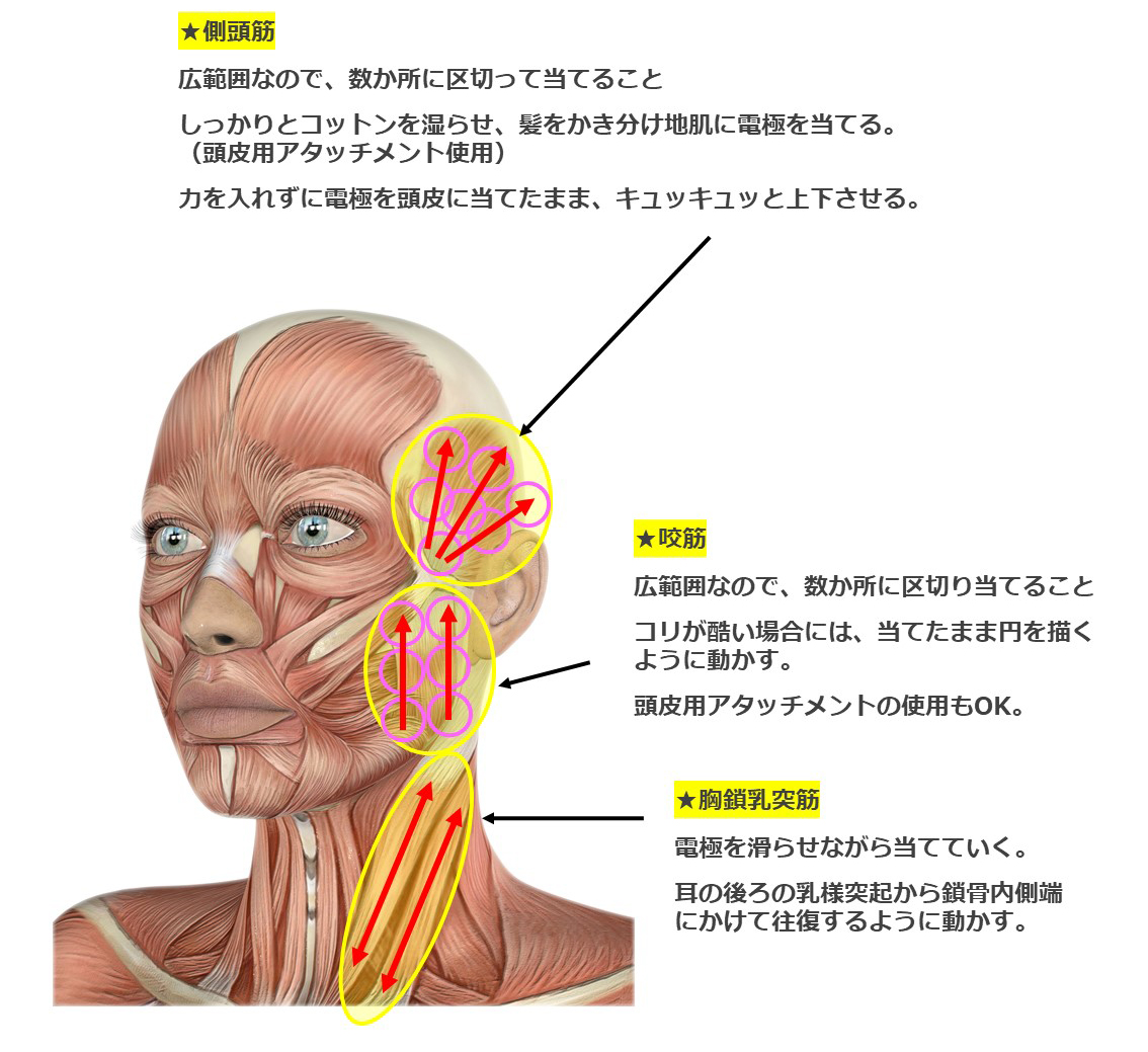 胸鎖乳突筋、咬筋、側頭筋リリース