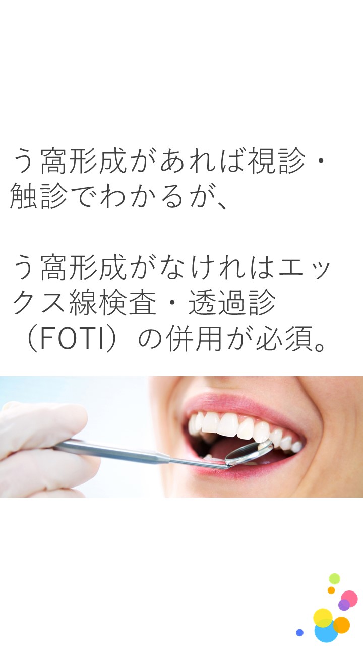 隣接面う蝕の診断に有効な検査方法はなんですか？