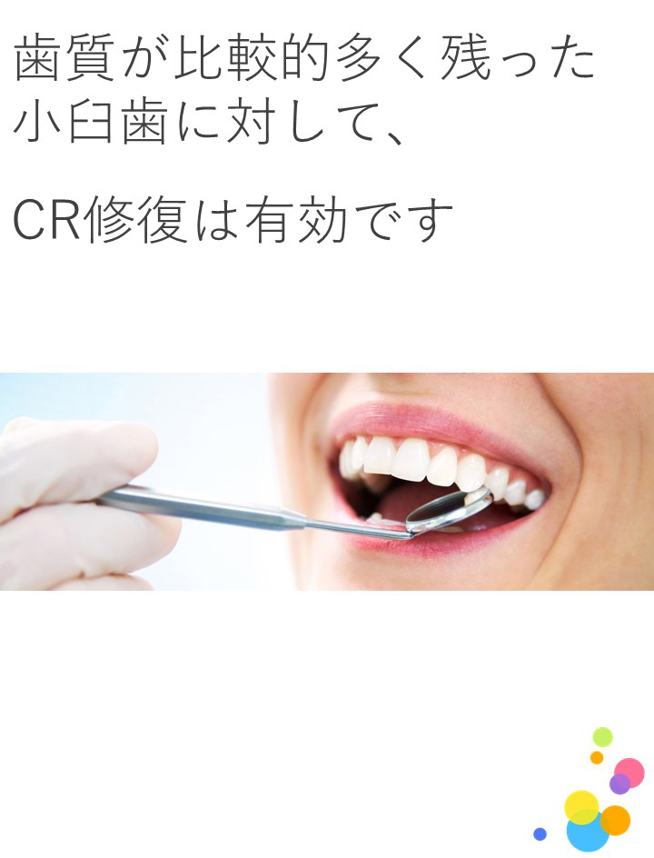 根治後の臼歯部修復にCRは有効ですか？