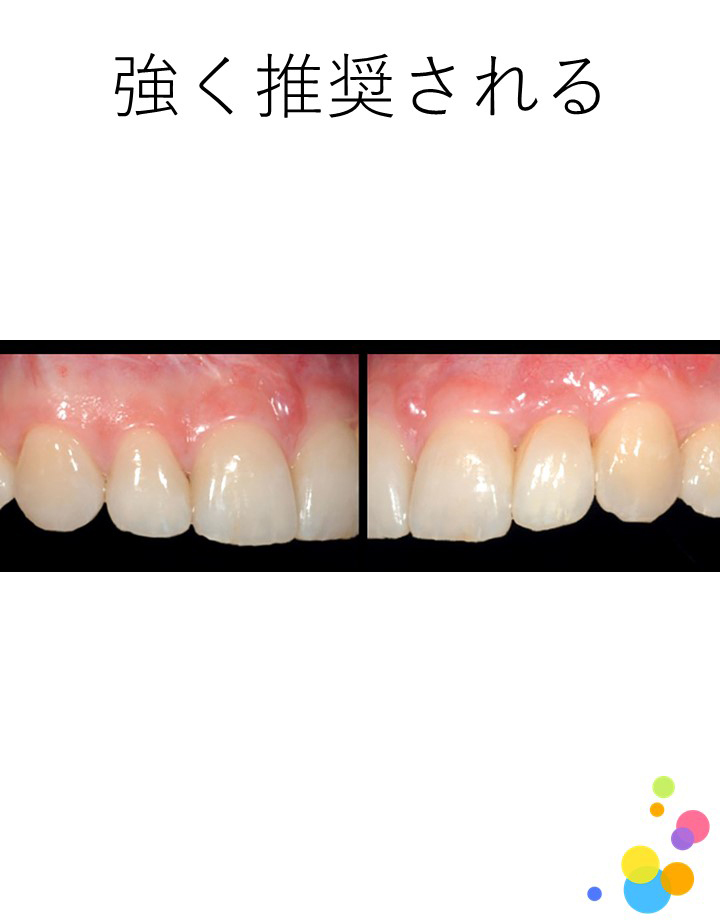 接着操作に対して，接着性レジンセメントの使用は推奨されるか？  