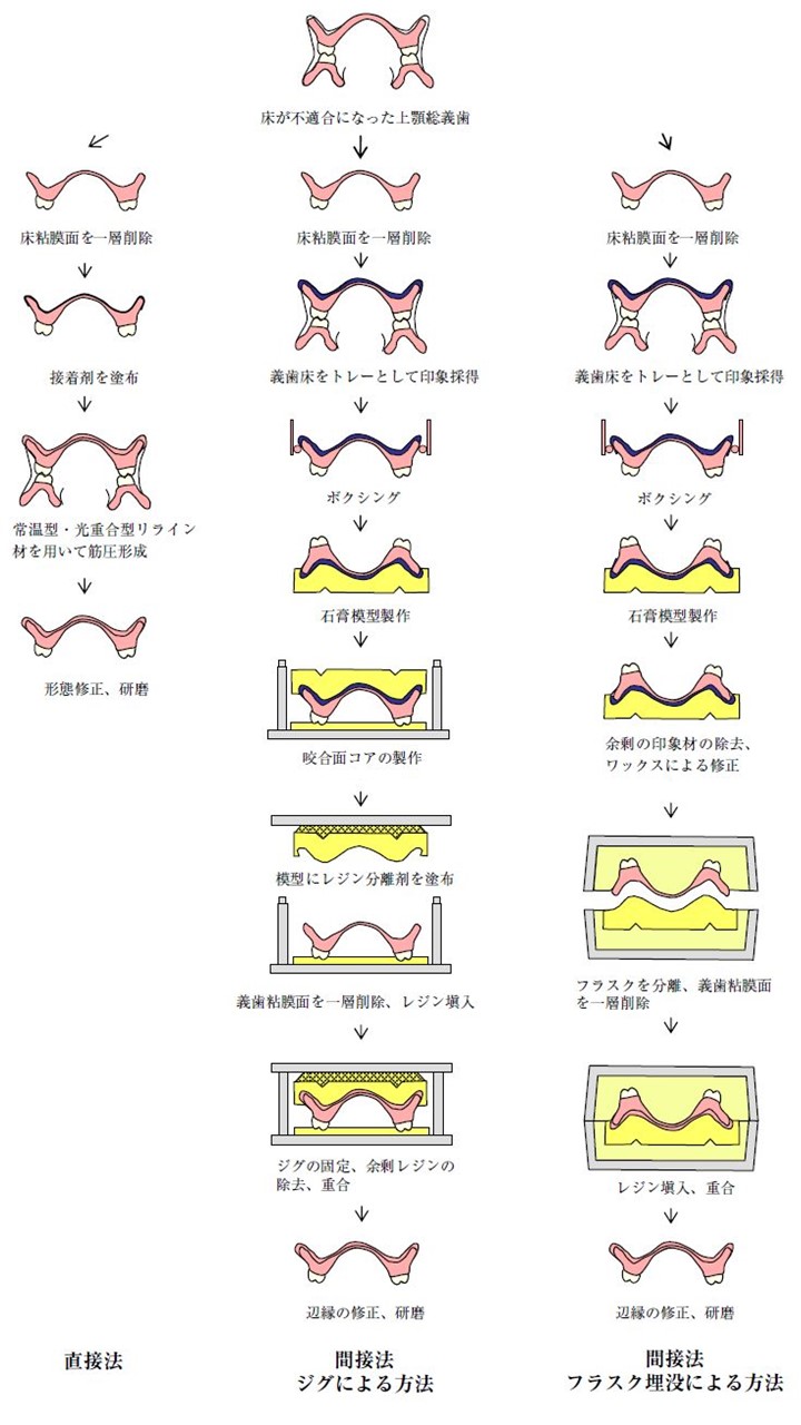 リライン法の選択基準は？