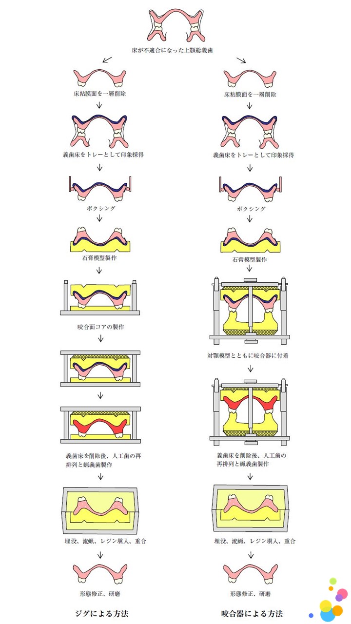 リベースの選択基準は？ 