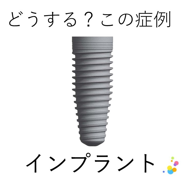 インプラントに関する質問 リンク集