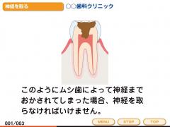 デンタルIQさん4「パソコン用ソフト」