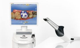 CEREC Omnicam