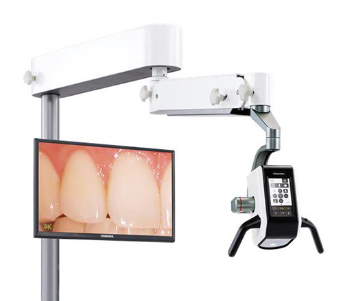 ネクストビジョン プラス