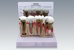 歯周病と歯の疾患