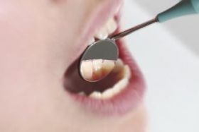 ハーネンクラット 歯鏡 − 製品情報｜OralStudio オーラルスタジオ