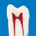 歯内療法用模型歯 [A12A-500]