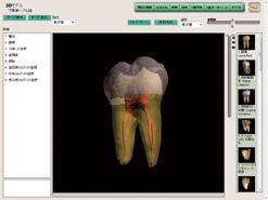 3D Tooth Atlas
