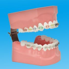 歯磨き指導顎模型（矯正） [PE-ORT002]