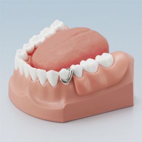 口腔ケア指導顎模型 [PE-STP011]