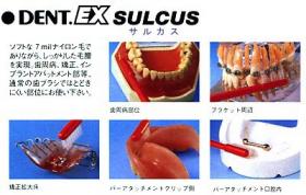 DENT.EX SULCUS